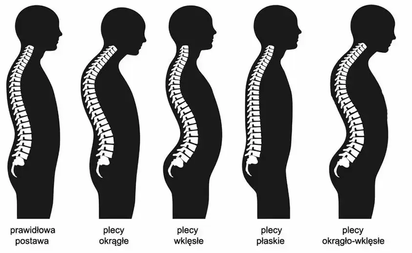 Improve Your Posture: How to Exercise for a Healthy Spine
